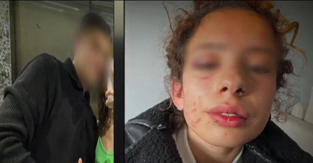 Sevgilisine işkence yaptı!